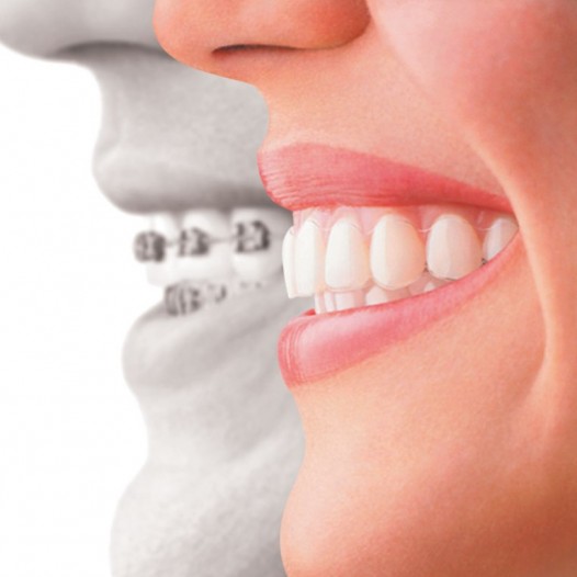 Orthodontics & Dentofacial Orthopaedics JCD Dental College